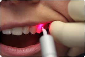 laser dentist
